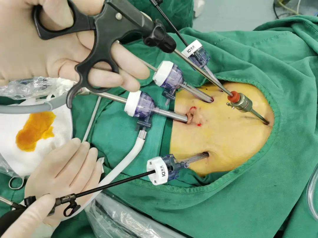 微信图片_20220110101159.jpg 微信图片_20220110101159.jpg